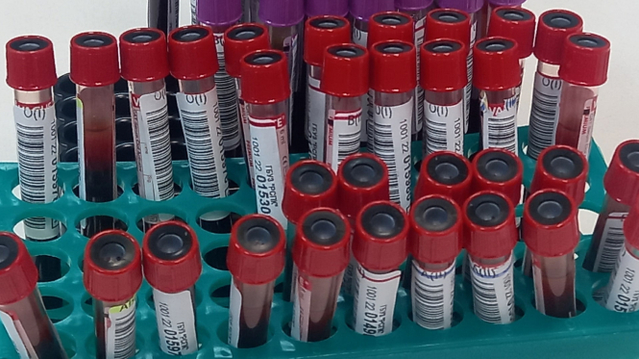 5 марта в Кондопоге состоится выездная донорска...