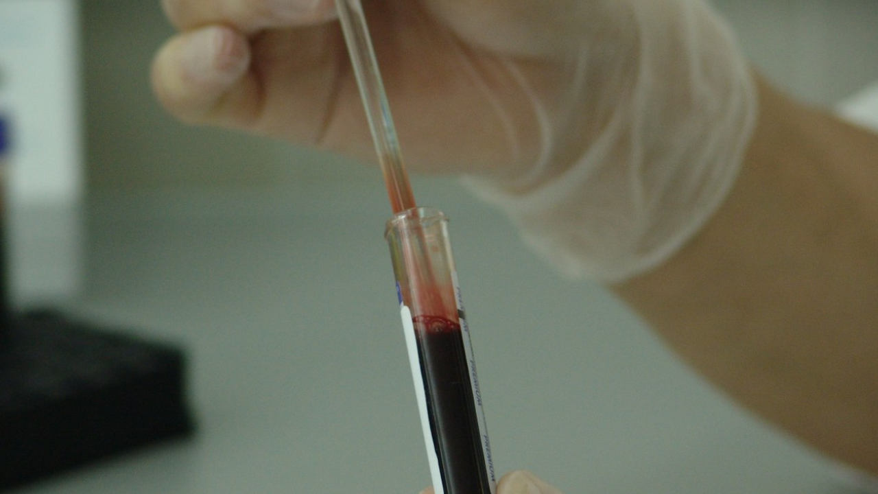 Учёные выяснили, что обладатели первой группы к...