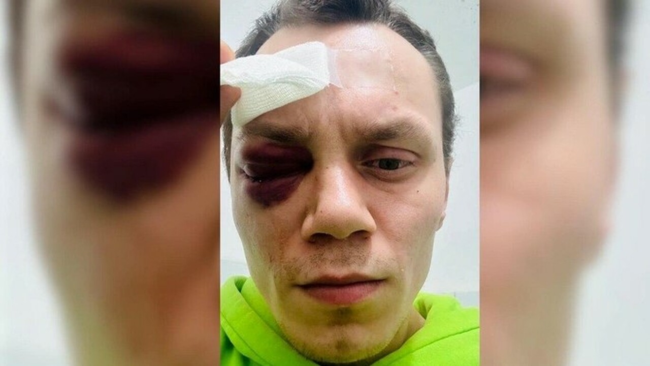 «Его будут выковыривать»: Боец ММА получил трав...