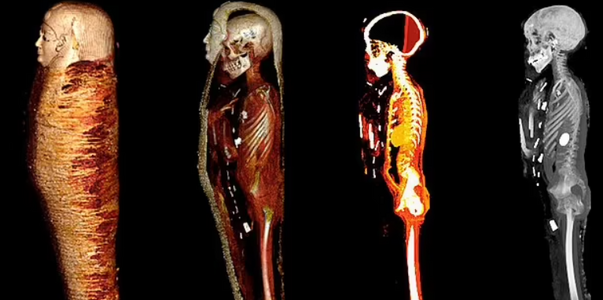 Ученые воссоздали лицо мумии «золотого мальчика...