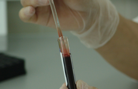 Ученые создали анализ крови, предсказывающий де...