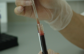 Ученые выяснили, как возраст донорской крови вл...